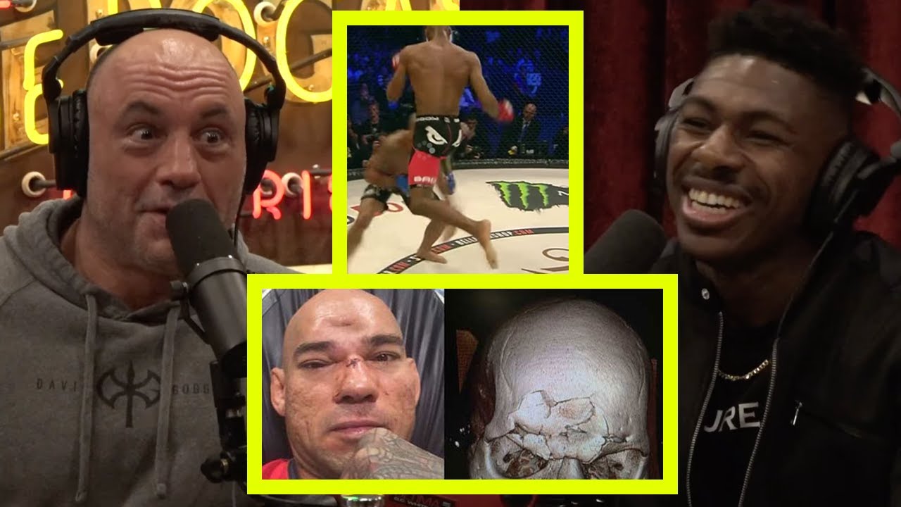 Reacts Most Insane MMA Injuries & Orbital Breaks & Bare Knuckle Boxing!